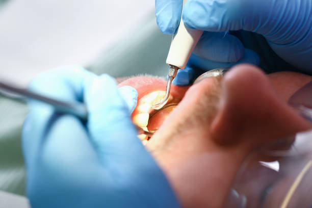 Best Emergency Treatment for Toothache in Mcdonough, GA