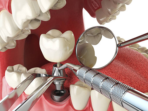 Best Pediatric Emergency Dentist in Mcdonough, GA